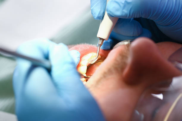 Best Emergency Treatment for Jaw Pain or Injury in Oglesby, IL