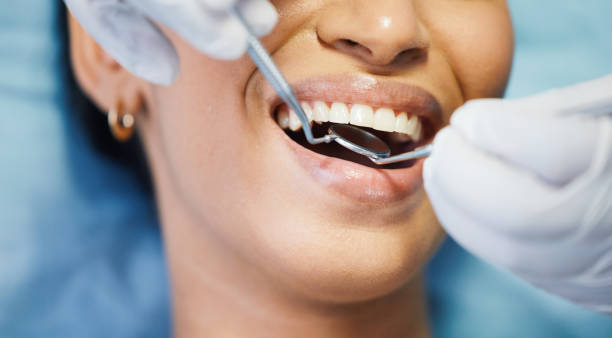 Best Walk-In Emergency Dental Services in Oglesby, IL
